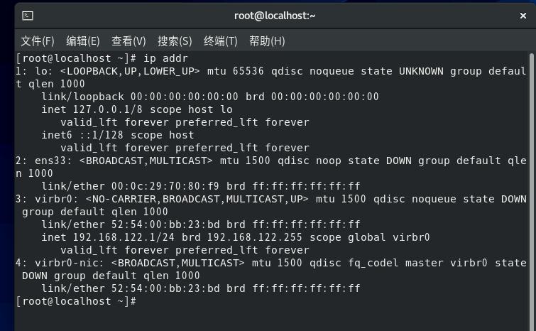 Linux系统如何开机自动获取ip地址 Csdn社区